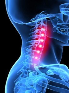 Compression of blood vessels in the cervical spine